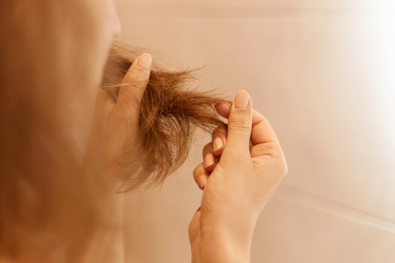 Hair Loss due to stress and anxiety: What You Should Know