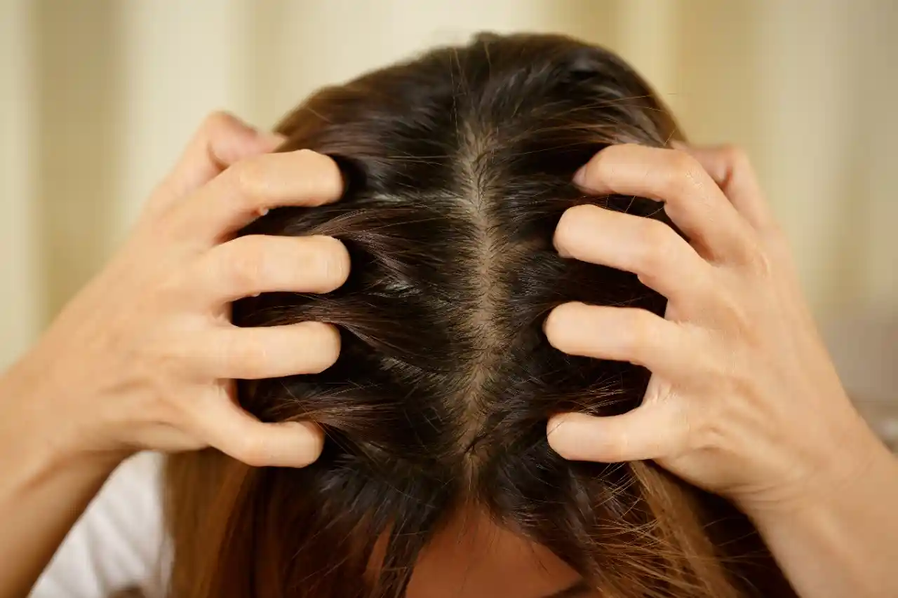 My hair is falling out from the root. What can I do?