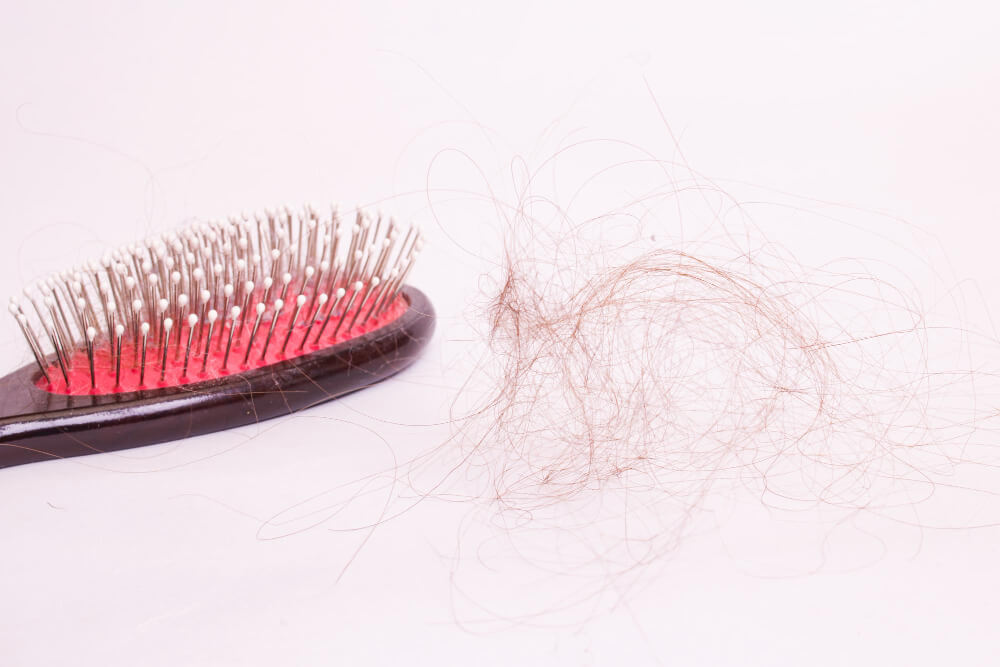 Types of hair loss