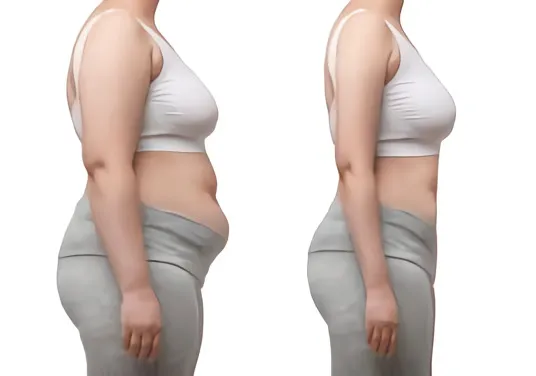 Wegovy Reviews from Real Patients 