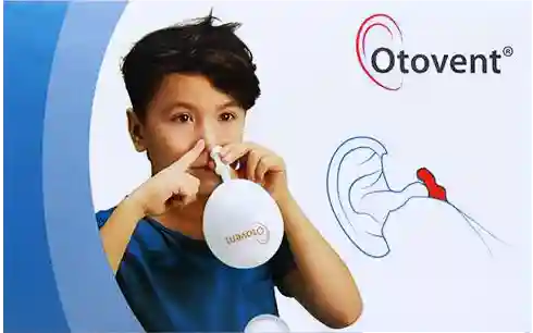 Otovent Treatment for Glue Ear