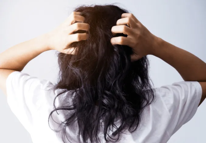 Head Lice & Scabies